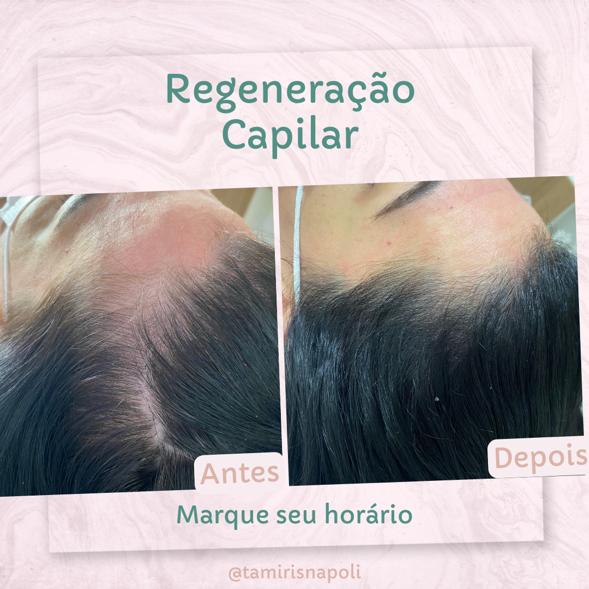 regeneracao-capilar.jpeg